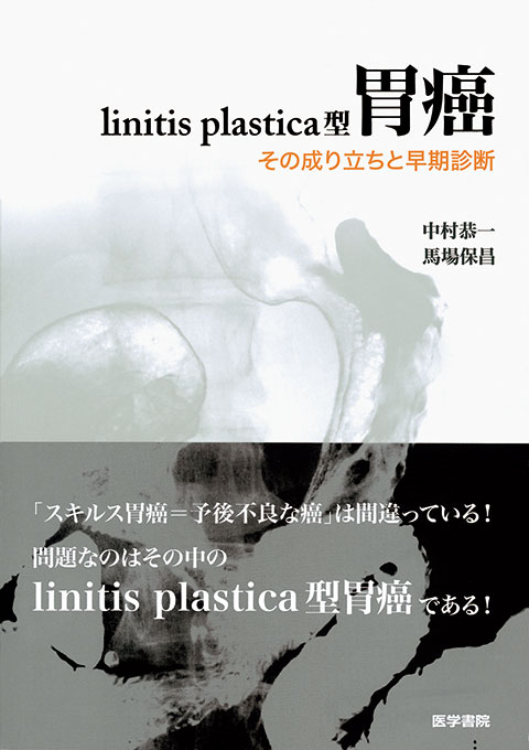linitis plastica型胃癌 | 書籍詳細 | 書籍 | 医学書院