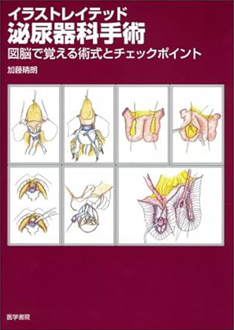 イラストレイテッド泌尿器科手術 | 書籍詳細 | 書籍 | 医学書院
