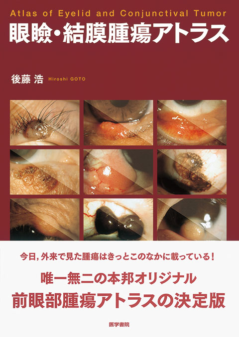 知っておきたい眼腫瘍診療 | 書籍詳細 | 書籍 | 医学書院