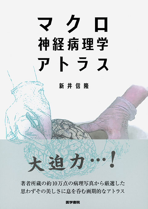 脳腫瘍臨床病理カラーアトラス 第5版 | 書籍詳細 | 書籍 | 医学書院