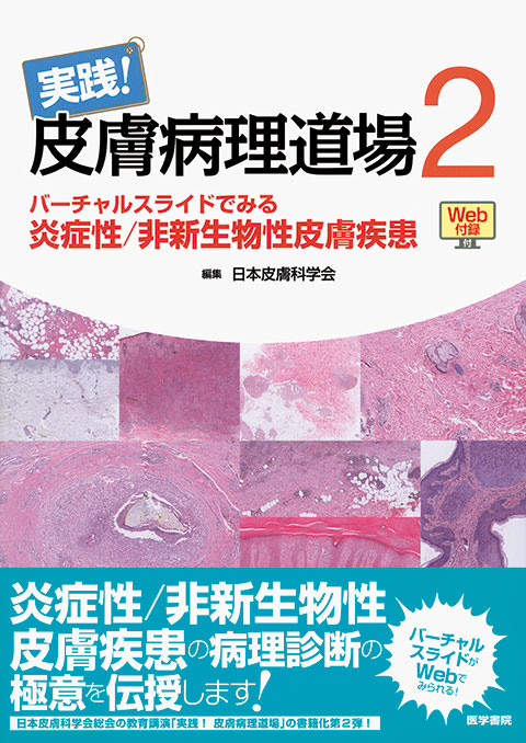皮膚血管炎 第2版 | 書籍詳細 | 書籍 | 医学書院