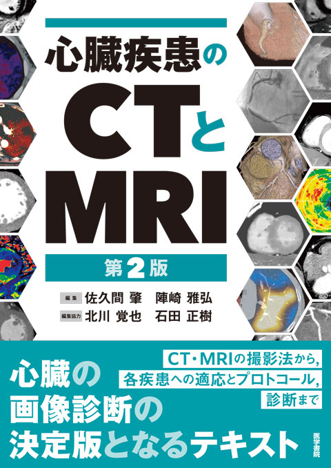 心臓疾患のCTとMRI 第2版 | 書籍詳細 | 書籍 | 医学書院