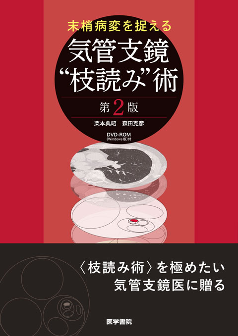 気管支鏡テキスト 第3版 | 書籍詳細 | 書籍 | 医学書院