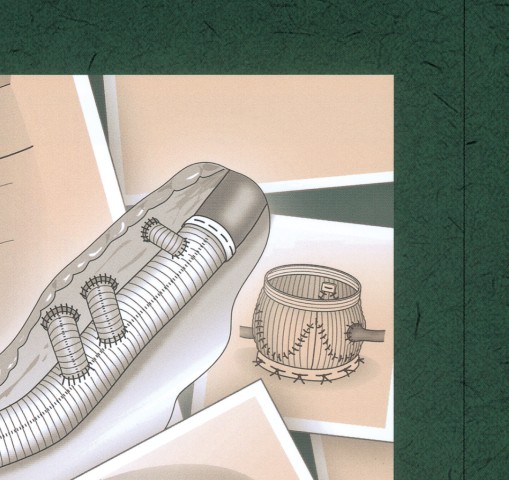 心臓・大動脈外科手術―基本・コツ・勘所』 立ち読み