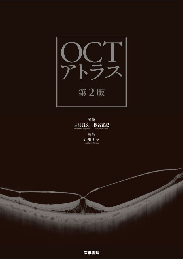 OCTアトラス_第2版_立読み