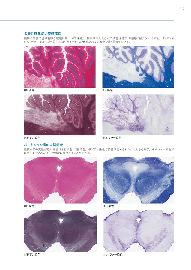 神経病理インデックス_第2版_立読み