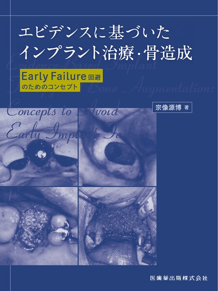 エビデンスに基づいたインプラント治療・骨造成 Early Failure回避の