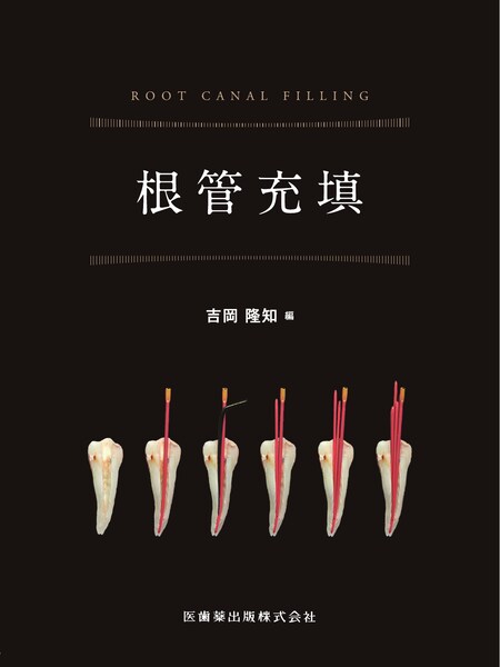 根管充填／医歯薬出版株式会社