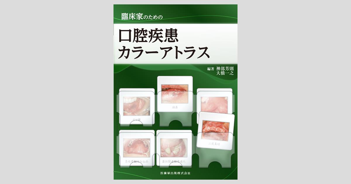 臨床家のための口腔疾患カラーアトラス／医歯薬出版株式会社