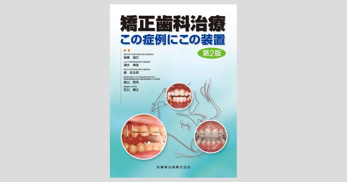 矯正歯科治療 この症例にこの装置 第2版／医歯薬出版株式会社