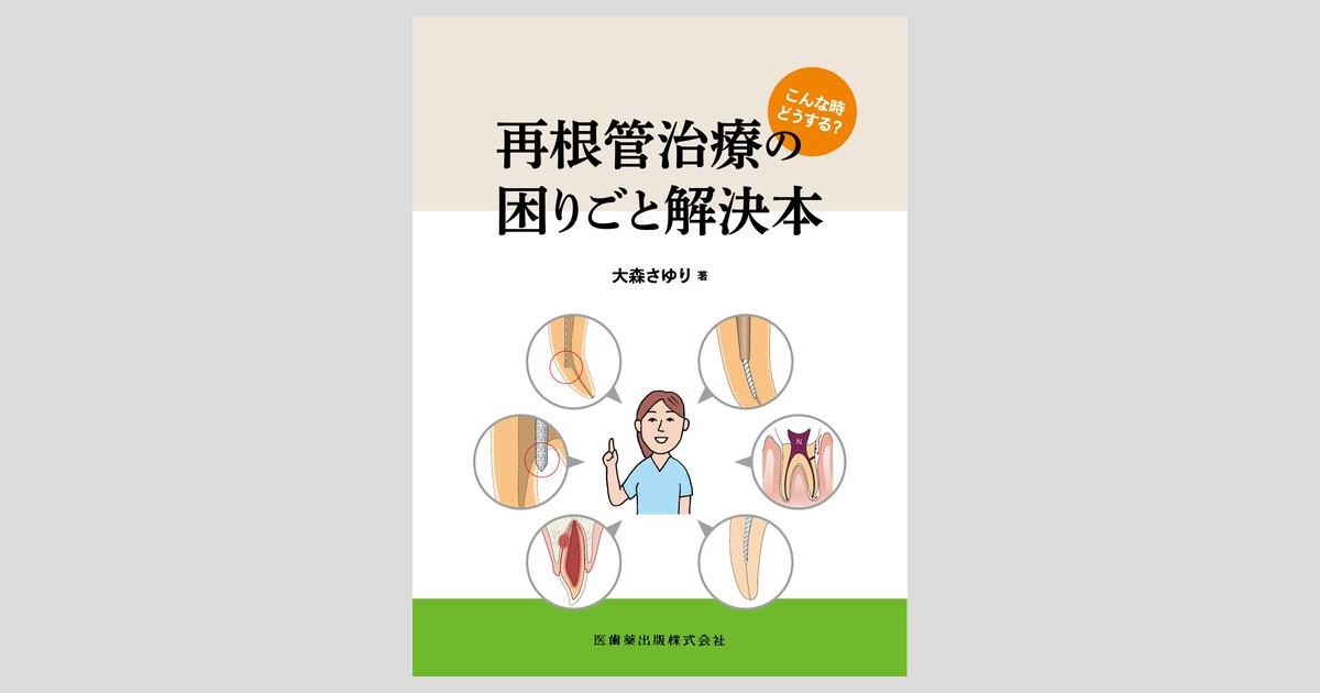 こんな時どうする？ 再根管治療の困りごと解決本／医歯薬出版株式会社