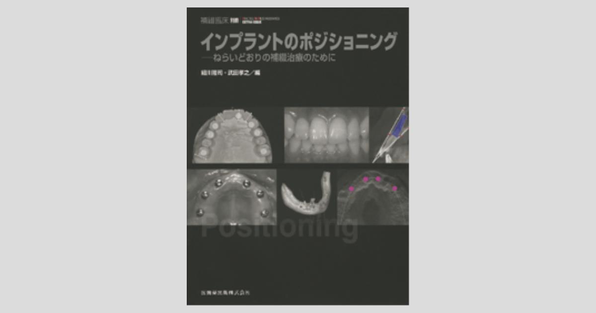 隔月刊「補綴臨床」別冊 インプラントのポジショニング ねらいどおりの