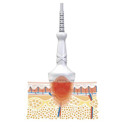 セルチューン＜CELLTUNE＞家庭用複合美容器 | 日本美容機オンライン