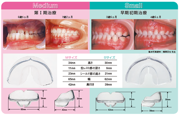 ムーシールド〔反対咬合用〕S・M《在庫限り》 | 株式会社 JM Ortho