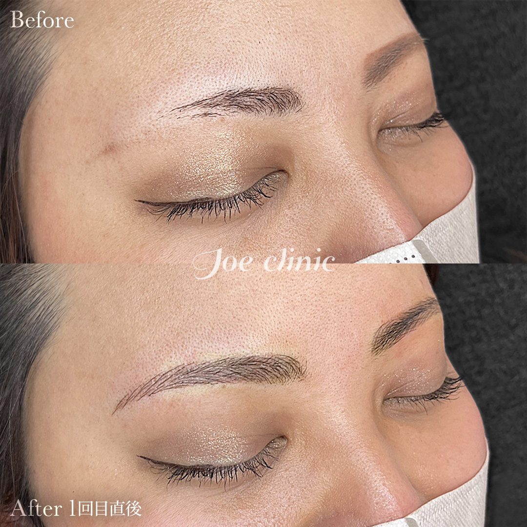 30代女性】眉アートメイク（4D/JOEオーダーメイド）｜1回目直後｜ 美容