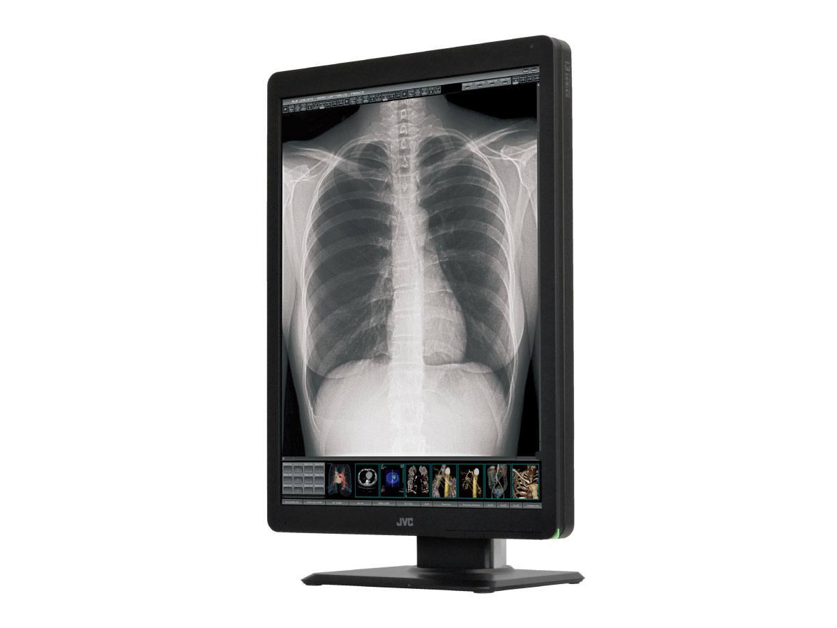 300万画素21.3型カラー液晶モニターCL-S300 | 医用モニター / 産業用