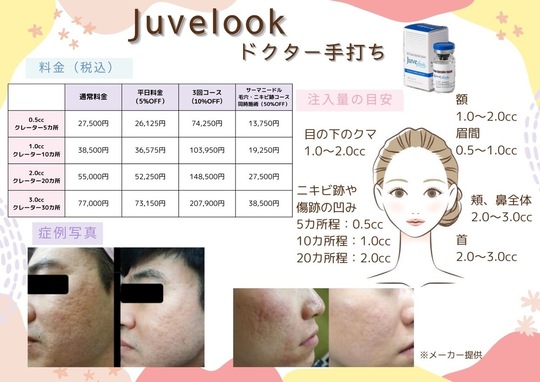 サーマニードルEVO - 南都留郡富士河口湖町の皮膚科 河口湖さおり皮ふ