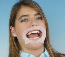 オプトラゲート − 製品情報｜OralStudio オーラルスタジオ