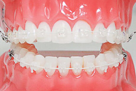 マスクで口を隠す今が矯正の始め時？｜大阪矯正歯科グループ 矯正歯科