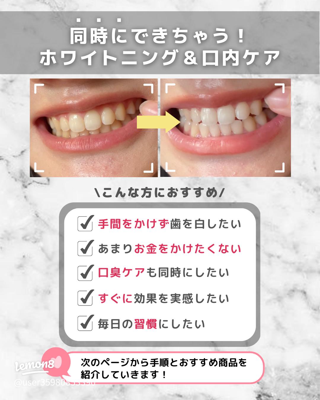 セルフホワイトニング すぐに始められます。