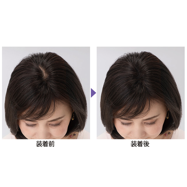 ハイネット ふんわりオン／部分ウィッグ | ライトアップオンラインストア