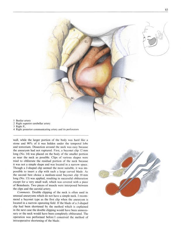 Sugita,-Microneurosurgical Atlas E-book Edition (電子版