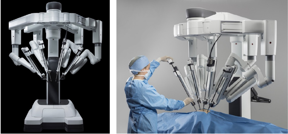 ロボット手術 – 愛媛大学大学院医学系研究科医学専攻 消化管・腫瘍外科