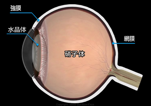 硝子体手術について｜望月眼科 老司本院 | 福岡市南区 | 多焦点レンズ