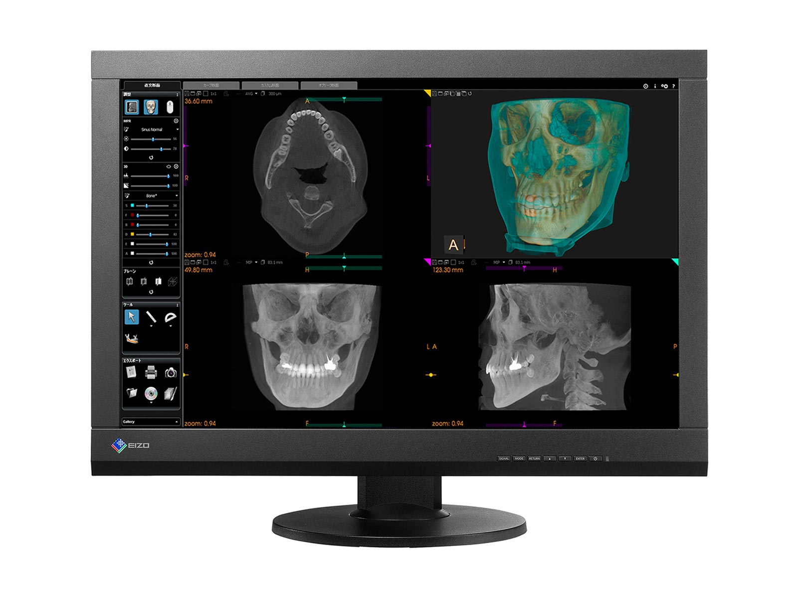 Eizo RadiForce RX440 4MP 30