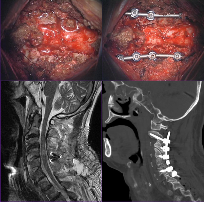 脊椎脊髄外傷 | 町田の脳神経外科・脊髄外科・神経内科「町田脳神経外科」