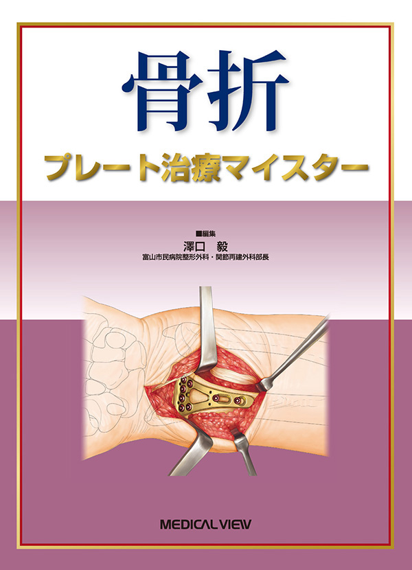 メジカルビュー社｜整形外科｜骨折 プレート治療マイスター