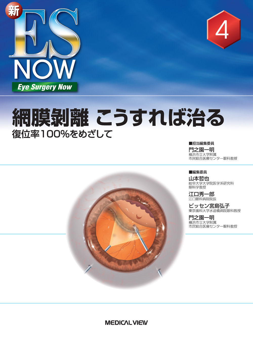 メジカルビュー社｜眼科｜新ES NOW 4 網膜剥離 こうすれば治る
