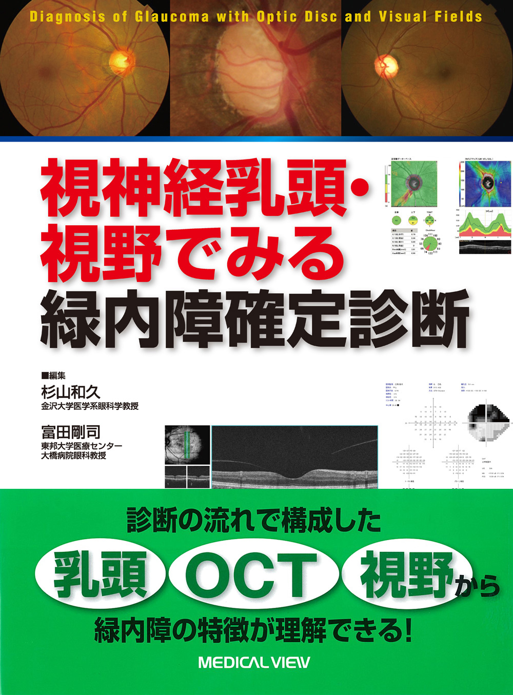 メジカルビュー社｜眼科｜視神経乳頭・視野でみる緑内障確定診断
