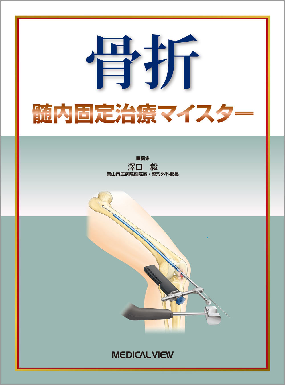 メジカルビュー社｜整形外科｜骨折 髄内固定治療マイスター