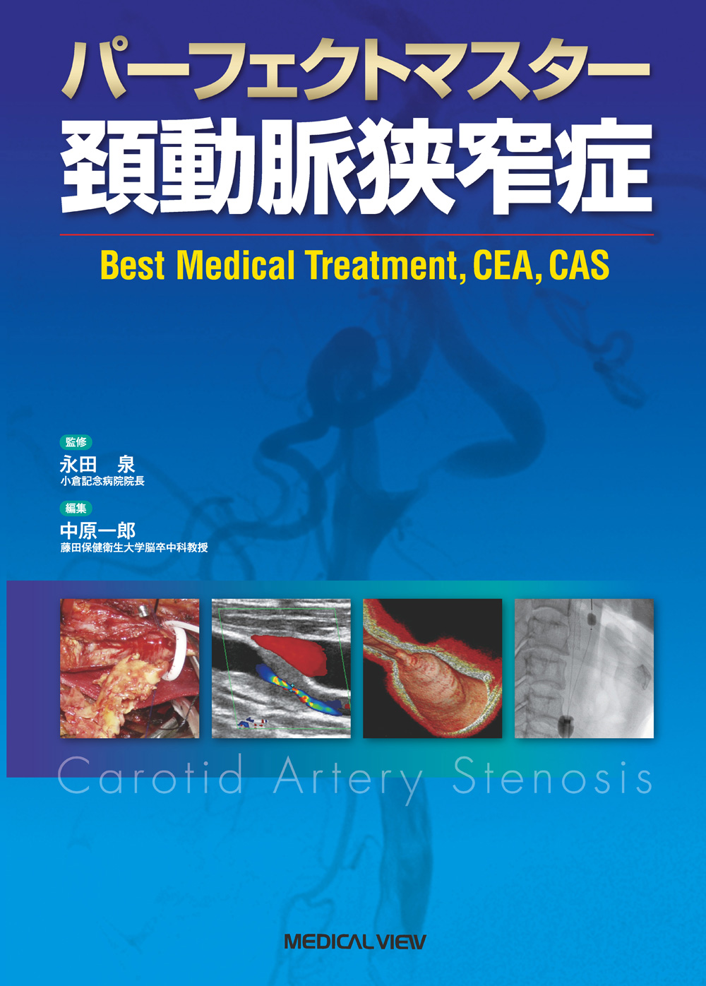 メジカルビュー社｜脳神経外科｜パーフェクトマスター 頚動脈狭窄症