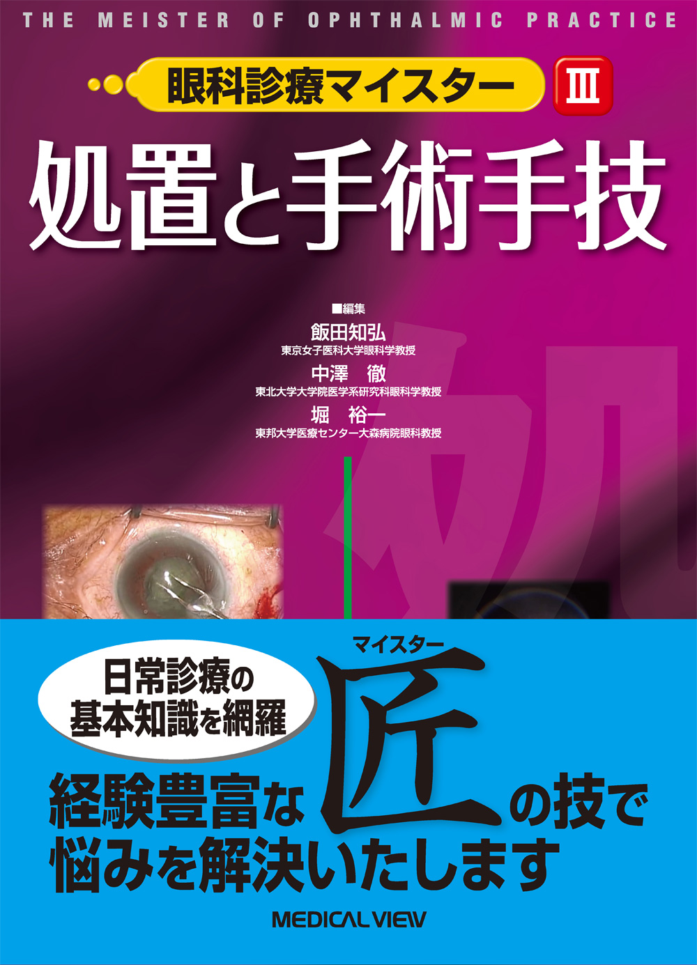 メジカルビュー社｜眼科｜眼科診療マイスター III 処置と手術手技