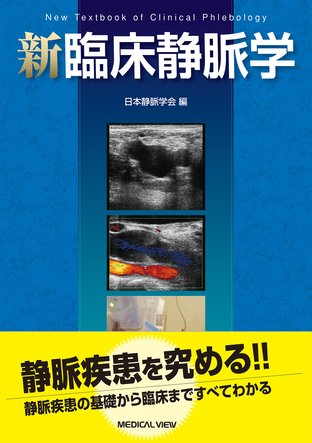 メジカルビュー社｜心臓血管外科｜新臨床静脈学