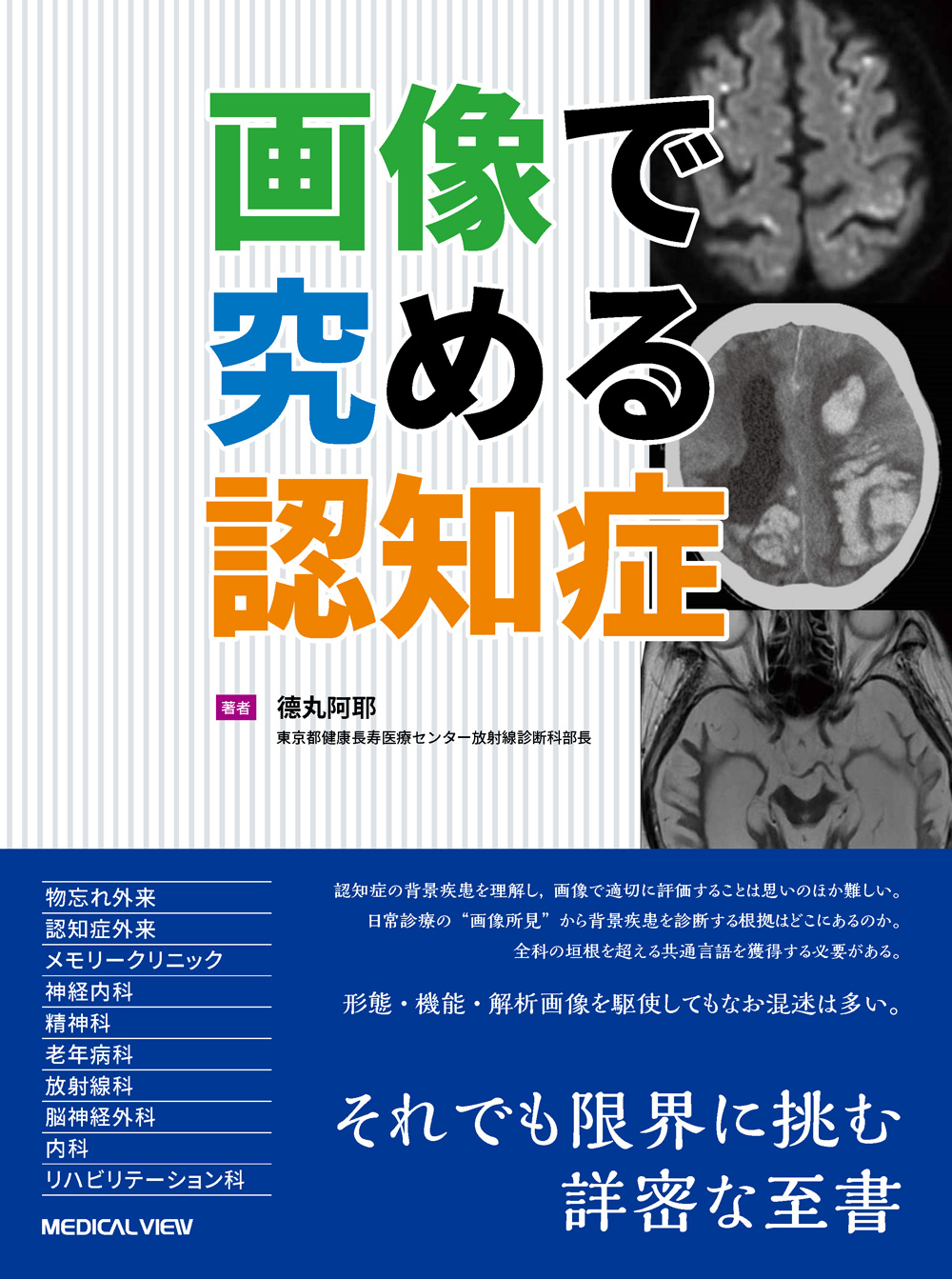 メジカルビュー社｜画像医学・放射線医学｜画像で究める認知症
