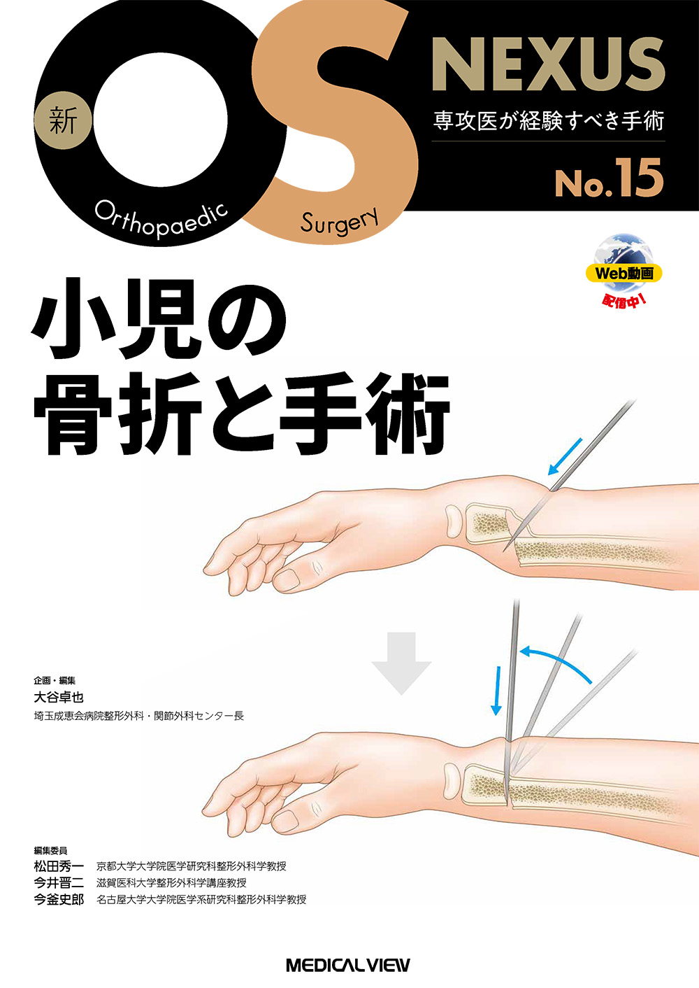 メジカルビュー社｜整形外科｜新OS NEXUS No.15 小児の骨折と手術［Web
