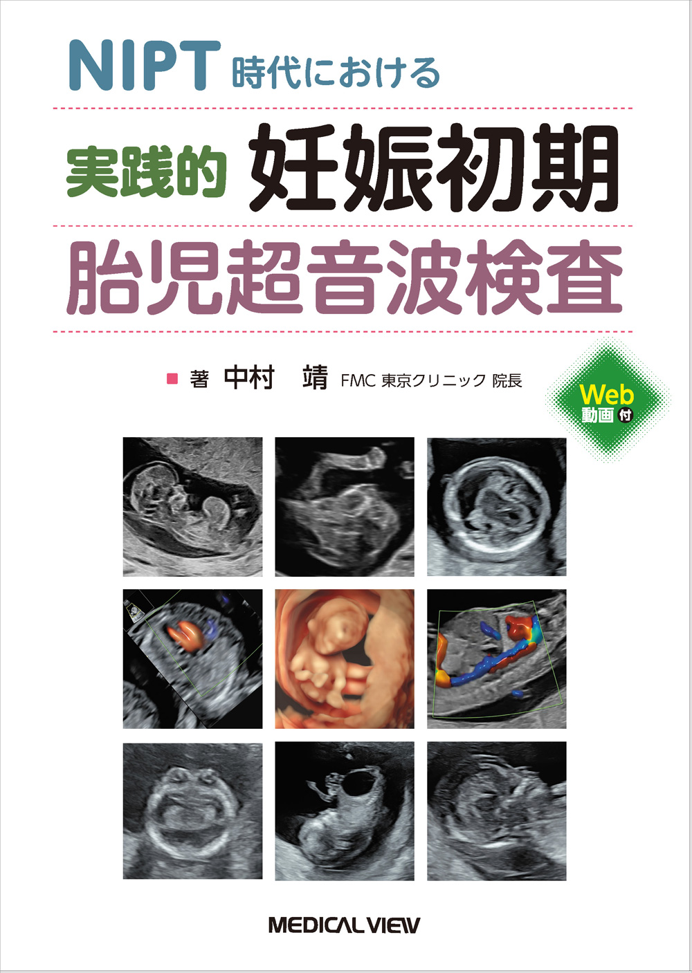 メジカルビュー社｜産婦人科・周産期医学｜実践的 妊娠初期胎児超音波