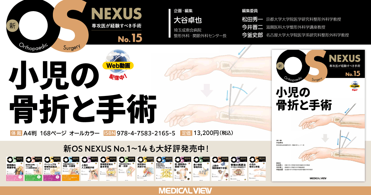 メジカルビュー社｜整形外科｜新OS NEXUS No.15 小児の骨折と手術［Web