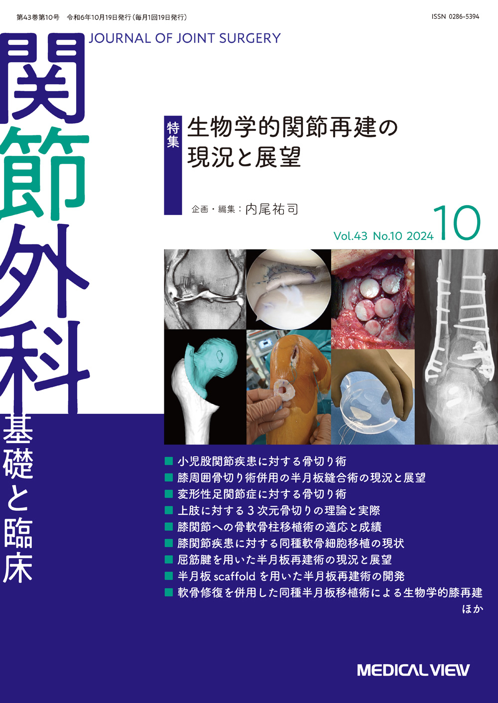 メジカルビュー社｜関節外科特集一覧｜関節外科 2024年10月号