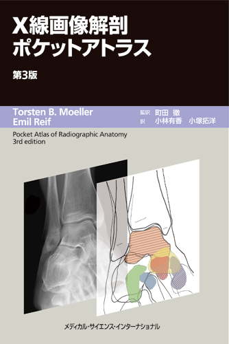 MEDSi)株式会社 メディカル・サイエンス・インターナショナル / X線