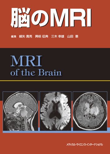 MEDSi)株式会社 メディカル・サイエンス・インターナショナル / 脳のMRI