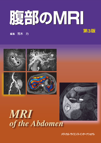 MEDSi)株式会社 メディカル・サイエンス・インターナショナル / 腹部の