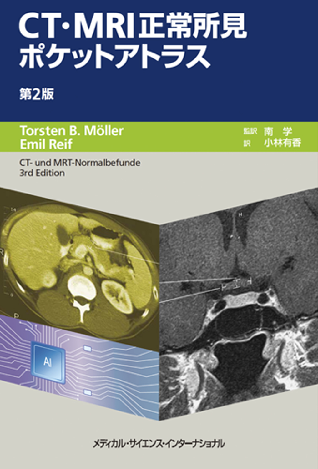 MEDSi)株式会社 メディカル・サイエンス・インターナショナル / CT