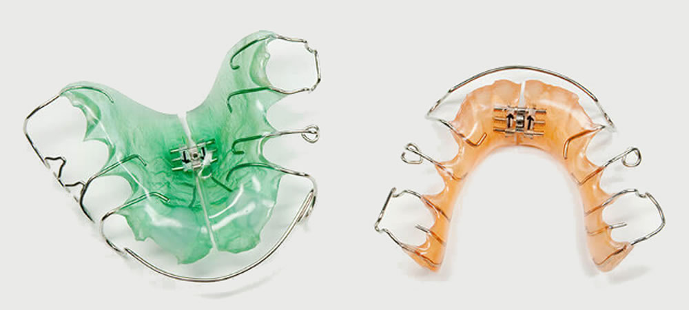 歯を抜かない・取り外しができる床矯正｜三鷹miki矯正歯科