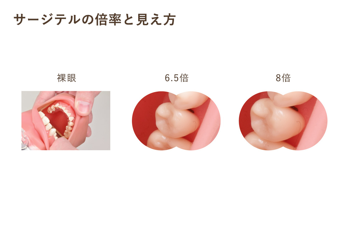 歯科用拡大ルーペ | 宮本歯科【公式】銀座駅徒歩1分、有楽町駅徒歩3分
