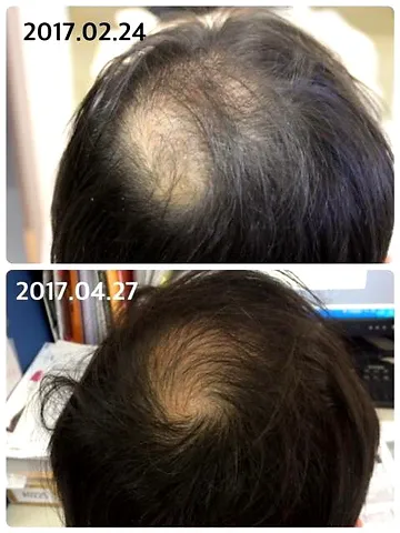 エキスパートローションとリアムールエキスパートセラムで叶う最高の