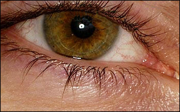 Medical Nikkor 120mm f/4.0 IF